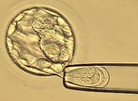试管移植二级胚胎的成功率高，还是移植4bb囊胚的成功率高？