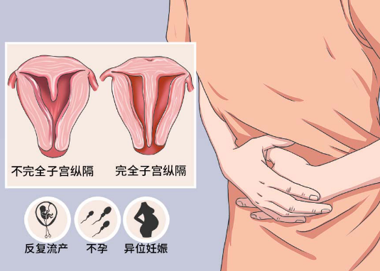 完全性纵隔子宫可以实现生育的梦想的吗？可以做试管婴儿吗？