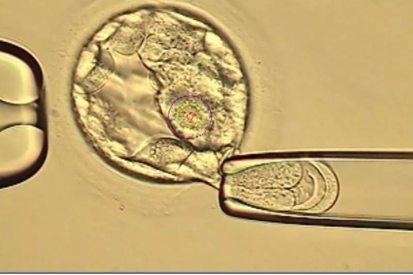 胚胎培育三天还不成熟能直接进行移植吗？