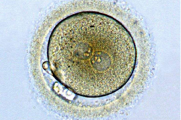 试管胚胎质量差别担心，养囊对提高移植成功率大有帮助