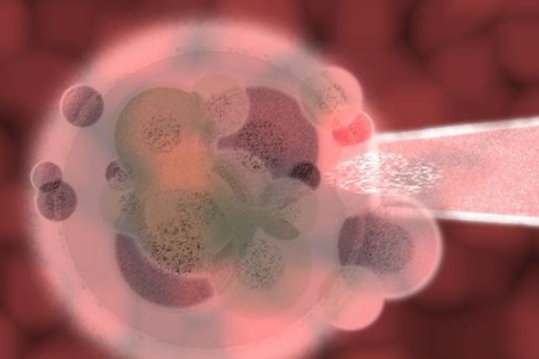 胚胎移植后肚子酥酥麻麻的是正常情况吗？