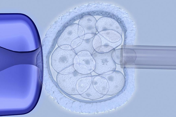 冻胚移植是常见的试管移植方式，步骤和注意事项一览
