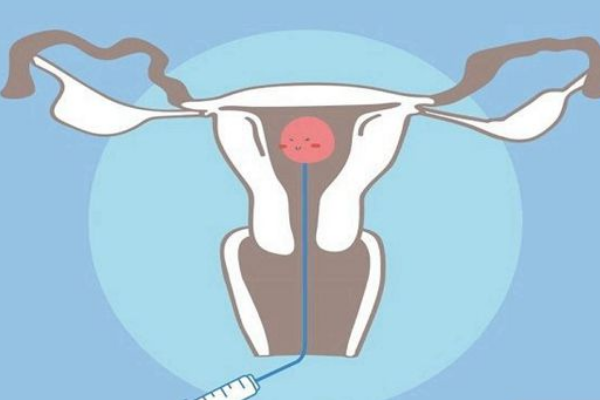 始基子宫做试管婴儿一次成功的几率有多大？