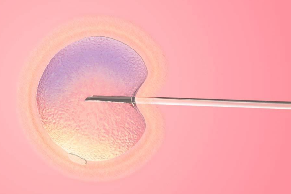 子宫内膜粘连直接做试管婴儿的成功率有多少？