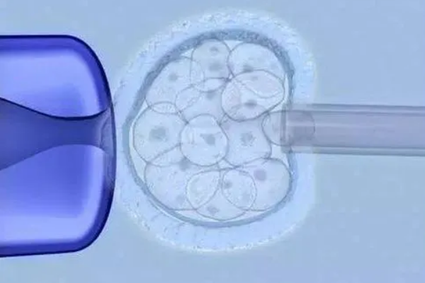 试管婴儿囊胚移植和鲜胚移植间有什么区别？