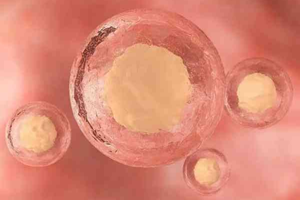 内膜结核的女性在试管前如何提高卵泡数量？