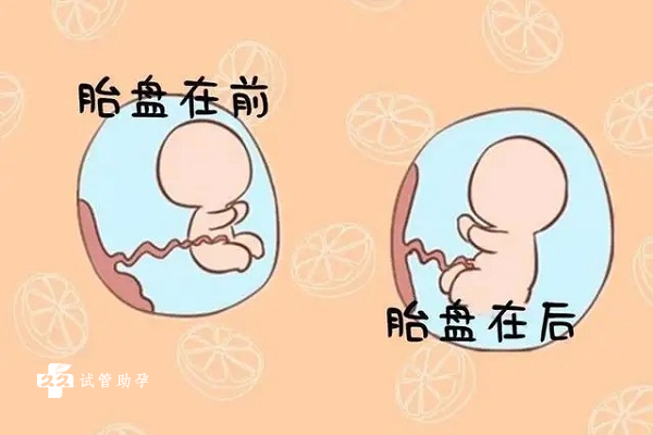 胎盘前壁和后壁都是孕期正常情况，哪个更显怀看完就知