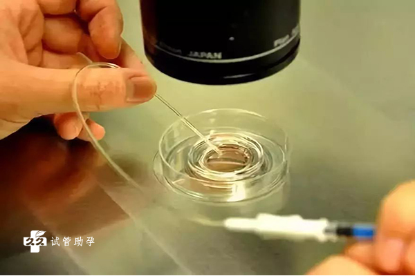 在上海仁济医院做供精试管助孕需要满足什么条件？
