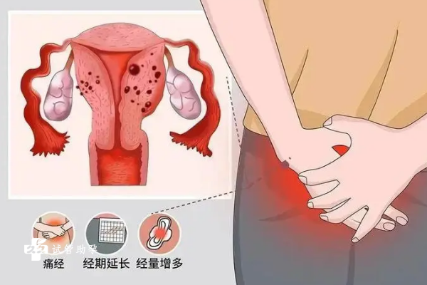 44岁子宫腺肌症患者能通过试管的方式怀孕吗？
