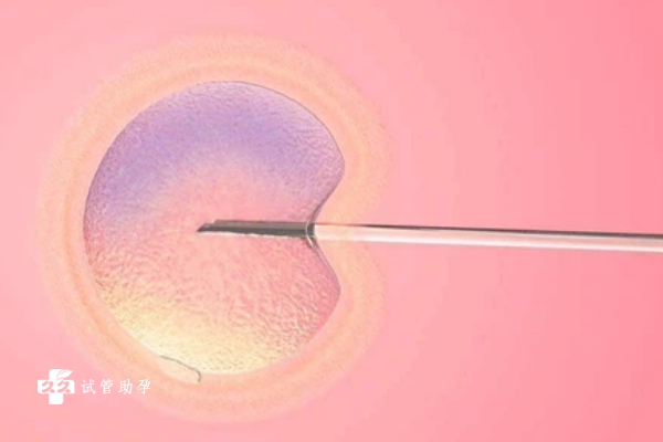 宫腔粘连做试管移植鲜胚好还是移植冻胚好？
