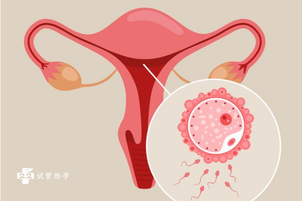 子宫内膜炎在北京做一次试管的费用是多少？