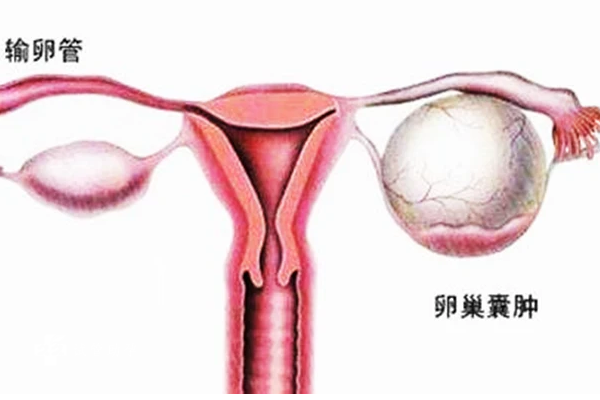 取卵手术后出现功能性囊肿什么时候能消？