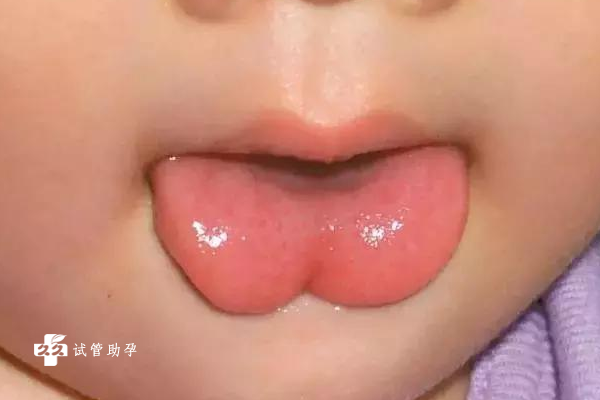 三个月的宝宝老是嚼舌头是什么原因导致的？
