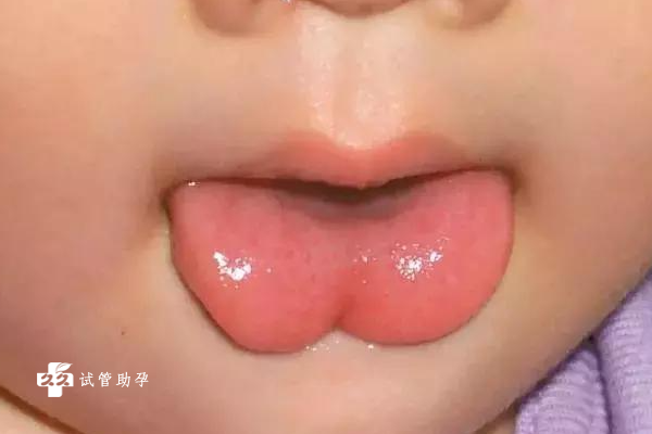 两个月婴儿老是嚼舌头是什么原因？