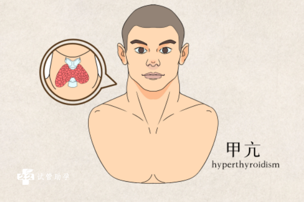 甲状腺亢进会影响试管移植的成功率吗？