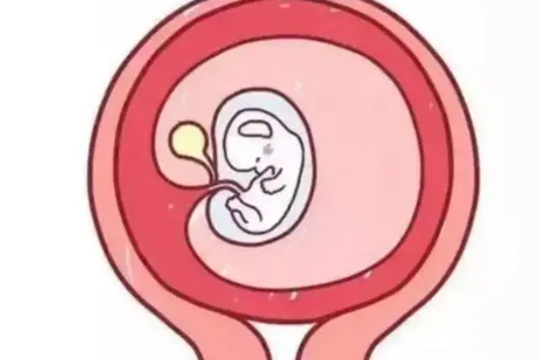 如何通过胎囊形状看男女？这个方法得到90%的宝妈认可！