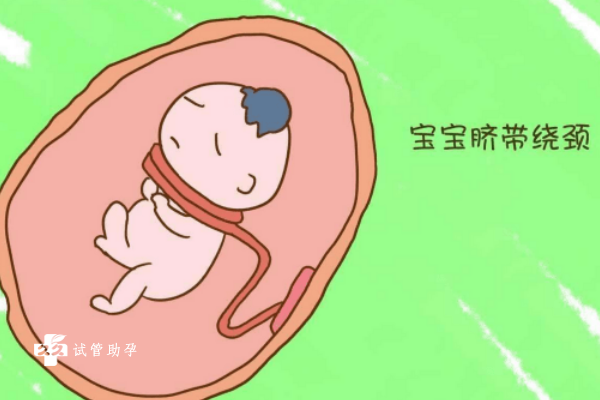 孕39周怎样能够防止胎儿脐带拧麻花？