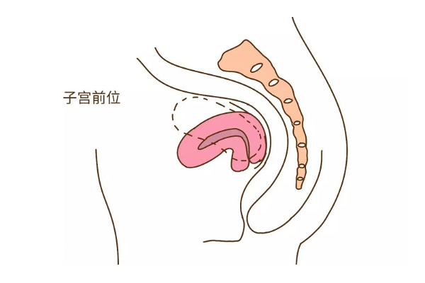 子宫前位和后位对试管婴儿有影响吗？影响是什么？