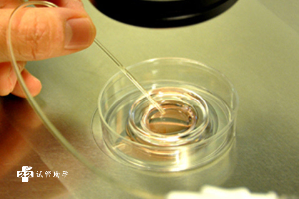 做三代试管能筛出几个囊胚？技术优势是什么？
