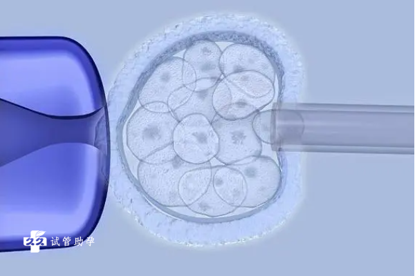 患有染色体易位在柬埔寨做三代试管能成功吗？受孕几率有多大？