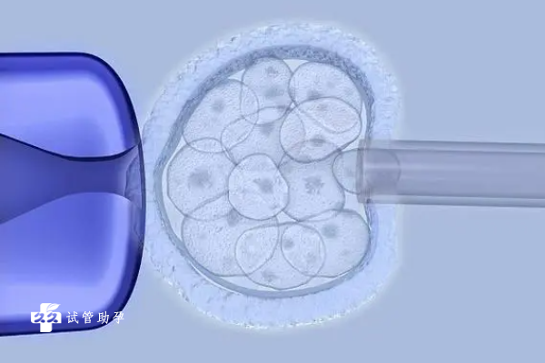试管技术有什么优势？能改善卵巢早衰吗？
