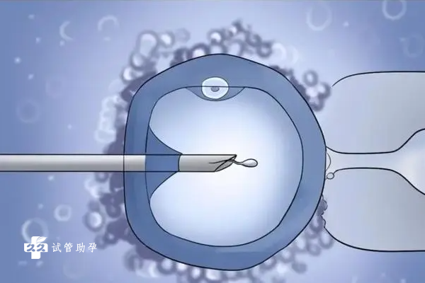 囊胚移植后尿频是着床成功的征兆吗？如何判断是否着床？