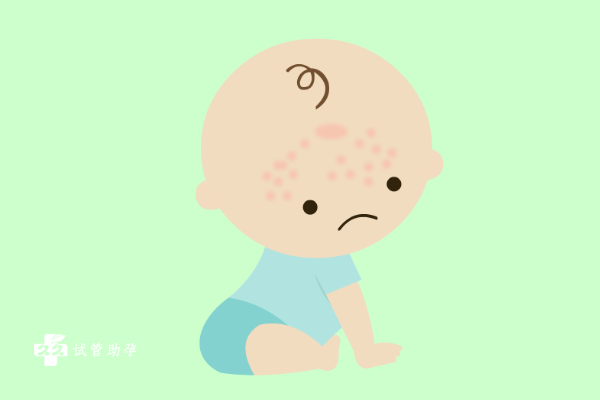 新生儿能用丝塔芙面霜预防湿疹吗？哪些洗涤用品适合新生儿？