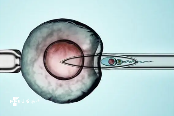 试管婴儿取卵时间和打促排卵药物的时间分别是什么？