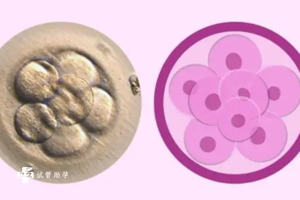 做试管配不成优质胚胎的原因分析，这三大因素都会产生影响