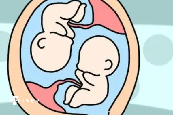 试管双胎预产期的计算方法公开，三种方案一文说清楚