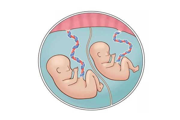 试管婴儿移植囊胚会出现双胞胎多胞胎的情况吗？