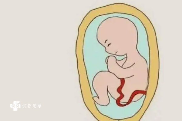 做试管婴儿出现臀位胎儿怎么办？成因是什么？