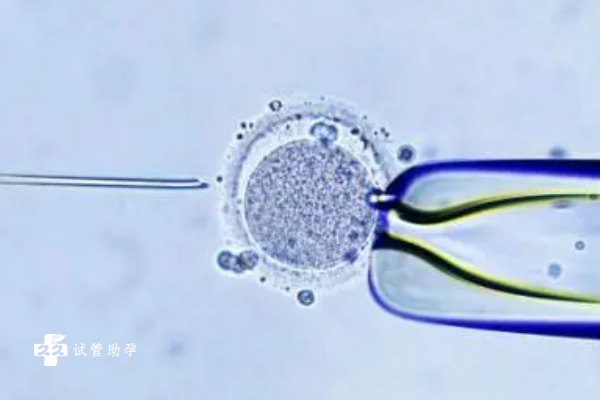 试管婴儿移植囊胚的具体步骤是什么？