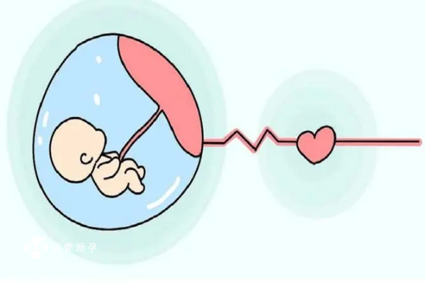 怀孕的时候如何自我检查胎停？