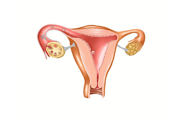 双侧卵巢小卵泡偏多的原因和治疗方法是什么？