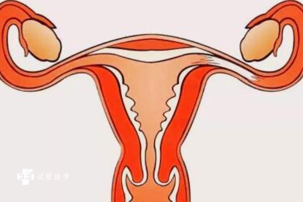 卵巢过度刺激综合症是什么？症状是什么？