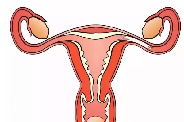 双侧输卵管不全梗阻是严重的不孕症吗？如何治疗？