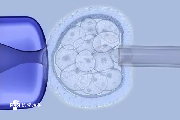 在试管婴儿自然周期需要保胎吗？如何进行保胎？