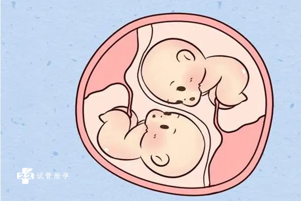 做试管婴儿可以放双胎吗？要考虑哪些因素？