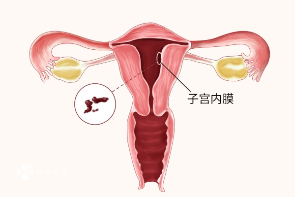 子宫内膜三线征是什么，形态完整且良好有利于胚胎着床