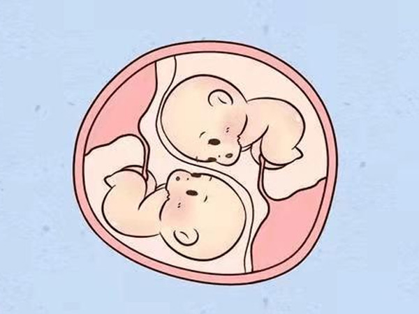 多胎妊娠